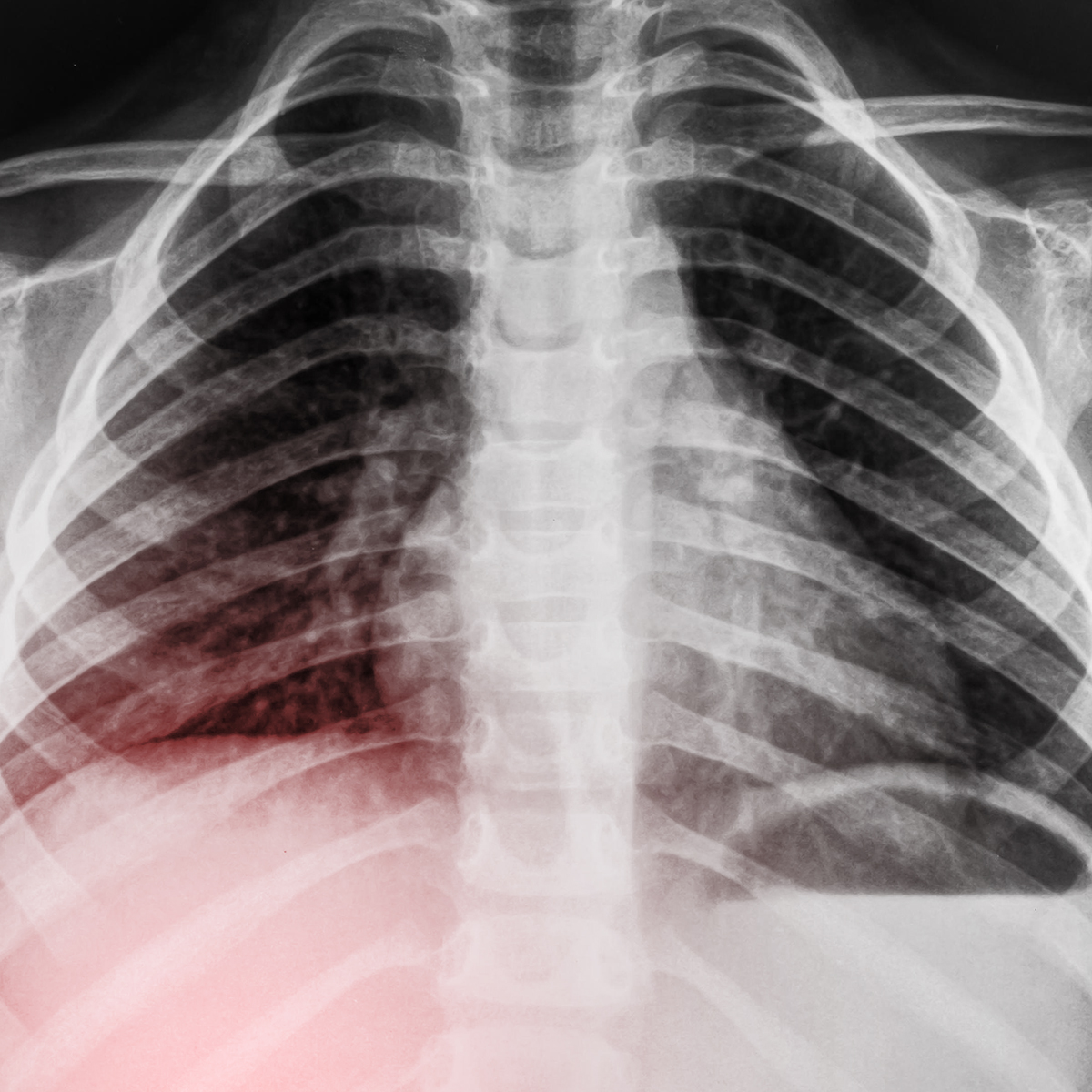 Digitalizadores de Rayos X: qué son, cómo funcionan y cuáles son sus ventajas