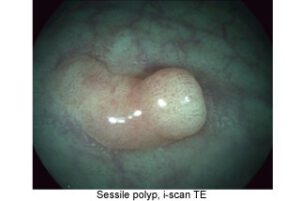 PENTAX Procesamiento de Imágenes